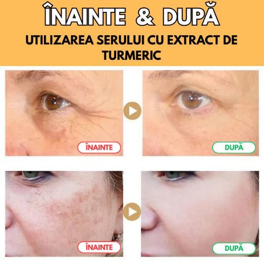 Ser Natural cu Extract de Turmeric pentru Riduri & Pete pigmentare
