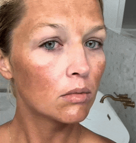Sapun cu Turmeric si ACID Kojic